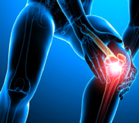 ligamento cruzado